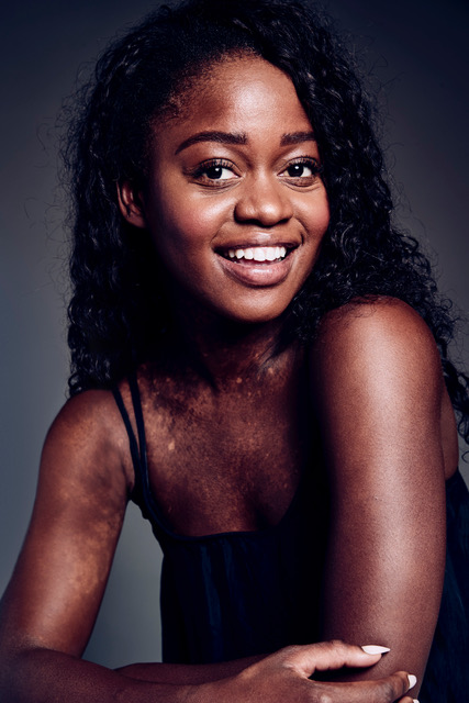 event inspiration | Michaela dePrince _ Sebastien Galtier